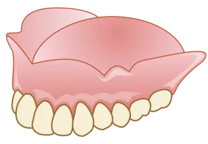 レジン床義歯（保険適用）