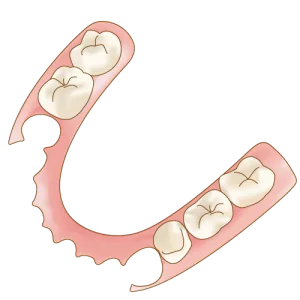 ノンクラスプデンチャーについて