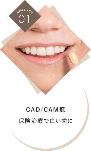 CAD/CAM冠